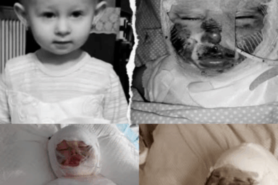 “Boiling Water, Broken Hearts — Saving Little Amelka”.